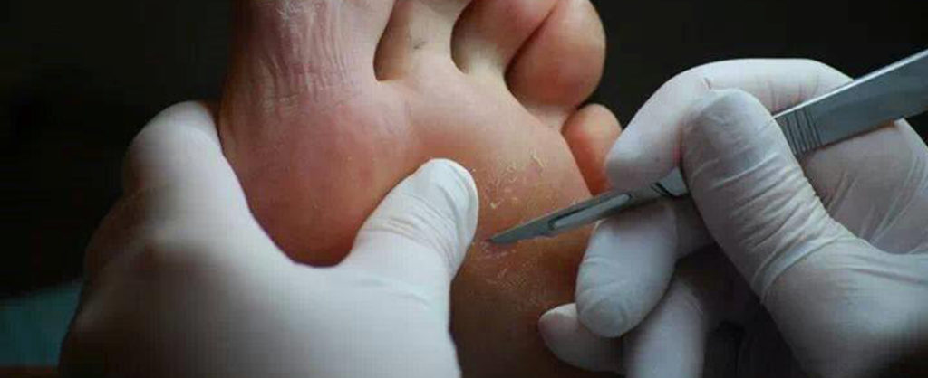 Medisch- en sportpedicure behandelingen | José Lauwers, uw adres voor uw (sport) medisch pedicurebehandeling, permanente make-up & medische pigmentatie. Laan van Meerdervoort 443, 2563 AS, Den Haag